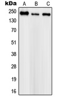SCN1A Polyclonal Antibody