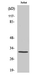 ELF5 Antibody in Western Blot (WB)