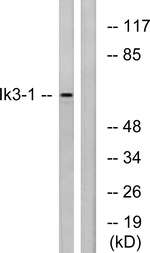 CABLES1 Antibody in Western Blot (WB)