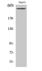 PIKFYVE Antibody in Western Blot (WB)