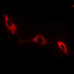 NKTR Polyclonal Antibody