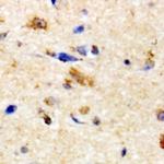 NKTR Antibody in Immunohistochemistry (Paraffin) (IHC (P))