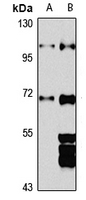 ZBTB17 Antibody in Western Blot (WB)