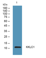 CT83 Polyclonal Antibody