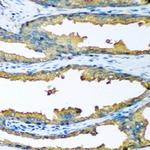 CYP46A1 Polyclonal Antibody