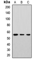 CYP46A1 Antibody in Western Blot (WB)