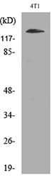 CD11d Antibody in Western Blot (WB)