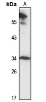 MRPL2 Polyclonal Antibody