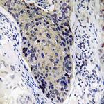 MRPL34 Antibody in Immunohistochemistry (Paraffin) (IHC (P))