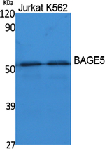 BAG5 Polyclonal Antibody
