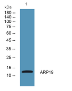 ARPP19 Polyclonal Antibody