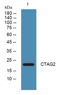 CTAG2 Polyclonal Antibody