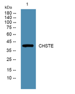 CHST14 Polyclonal Antibody