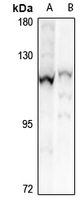CHSY3 Polyclonal Antibody