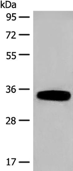 DHRS1 Antibody in Western Blot (WB)