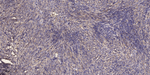 DYNC1H1 Antibody in Immunohistochemistry (Paraffin) (IHC (P))