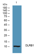 DYNLRB1 Polyclonal Antibody