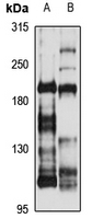LRP4 Polyclonal Antibody