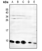 NDUFC1 Antibody in Western Blot (WB)