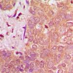 NAV1 Polyclonal Antibody