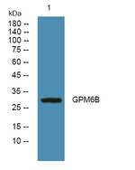 GPM6B Polyclonal Antibody