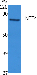 SLC6A17 Polyclonal Antibody