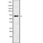 ARHGAP25 Polyclonal Antibody