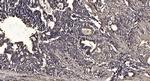 STK38L Polyclonal Antibody