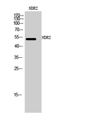 STK38L Antibody in Western Blot (WB)