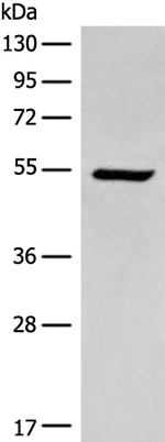 ACD Polyclonal Antibody