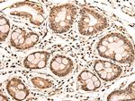 ASXL2 Antibody in Immunohistochemistry (Paraffin) (IHC (P))