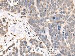 ASXL2 Antibody in Immunohistochemistry (Paraffin) (IHC (P))