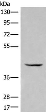 BBOX1 Antibody in Western Blot (WB)