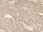 C1orf101 Antibody in Immunohistochemistry (Paraffin) (IHC (P))