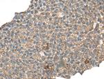CABP5 Antibody in Immunohistochemistry (Paraffin) (IHC (P))