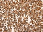 CACNA1B Antibody in Immunohistochemistry (Paraffin) (IHC (P))