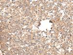 CACNG5 Polyclonal Antibody