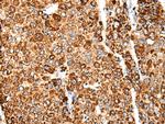 CACNG5 Antibody in Immunohistochemistry (Paraffin) (IHC (P))