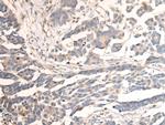 CAPN14 Polyclonal Antibody