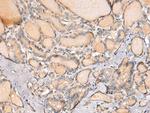CAPN14 Antibody in Immunohistochemistry (Paraffin) (IHC (P))