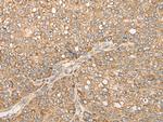 Calpain 15 Antibody in Immunohistochemistry (Paraffin) (IHC (P))