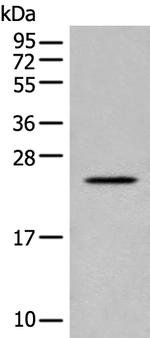COP1 Antibody in Western Blot (WB)