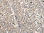 CC2D1A Antibody in Immunohistochemistry (Paraffin) (IHC (P))