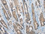 CCIN Polyclonal Antibody