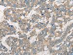 CCIN Antibody in Immunohistochemistry (Paraffin) (IHC (P))