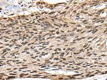 CCNB1IP1 Polyclonal Antibody