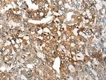 CCNB1IP1 Antibody in Immunohistochemistry (Paraffin) (IHC (P))