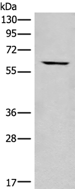 CCT6B Antibody in Western Blot (WB)