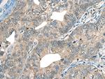 CDADC1 Polyclonal Antibody
