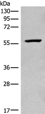CDADC1 Antibody in Western Blot (WB)